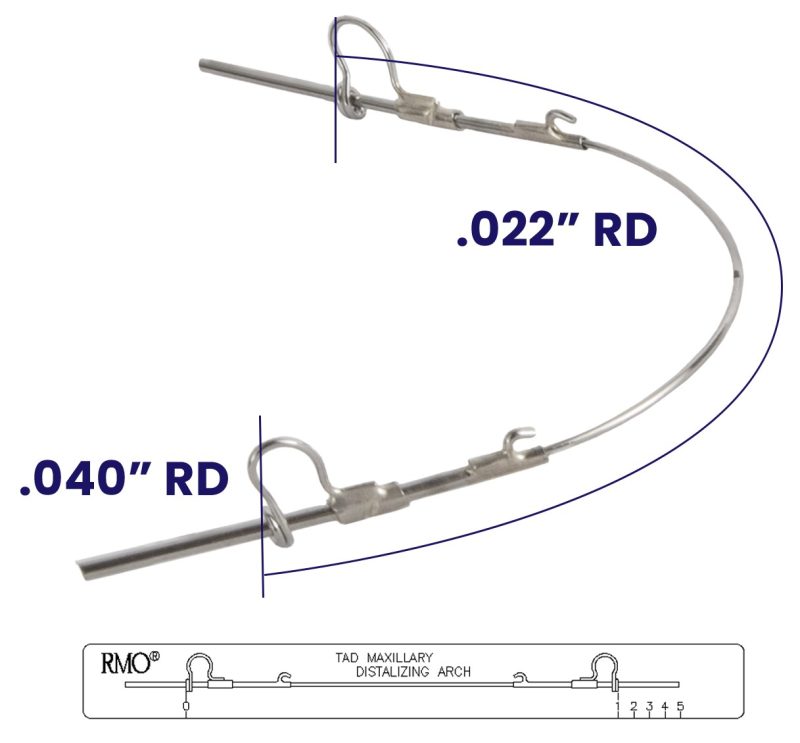 a04155 3d maxillary distalizing arch