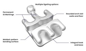 km04802 synergy fx one piece stainless steel brackets diagram