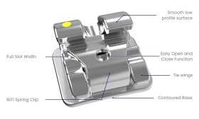 m12210 alpine sl two piece stainless steel brackets bioprogressive rx diagram